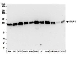 KAP1 Antibody (BL-248-2G6), Novus Biologicals 100 &mu;L; Unconjugated:Antibodies,