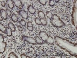 KAP1 Antibody (4E6), Novus Biologicals 0.1 mg | Buy Online | Novus Biologicals | Fisher Scientific