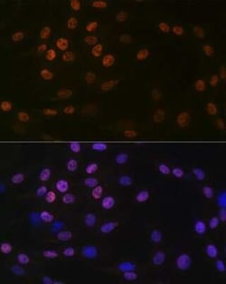 KAT1 Rabbit anti-Human, Mouse, Rat, Clone: 7U2O3, Novus Biologicals:Antibodies:Primary