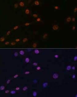 KAT1 Rabbit anti-Human, Mouse, Rat, Clone: 7U2O3, Novus Biologicals:Antibodies:Primary