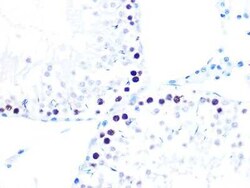 KAT1 Rabbit anti-Human, Mouse, Rat, Clone: 7U2O3, Novus Biologicals:Antibodies:Primary