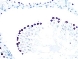 KAT1 Rabbit anti-Human, Mouse, Rat, Clone: 7U2O3, Novus Biologicals:Antibodies:Primary