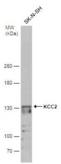 KCC2/SLC12A5 Antibody, Novus Biologicals 100 &mu;g | Buy Online | Novus Biologicals | Fisher Scientific