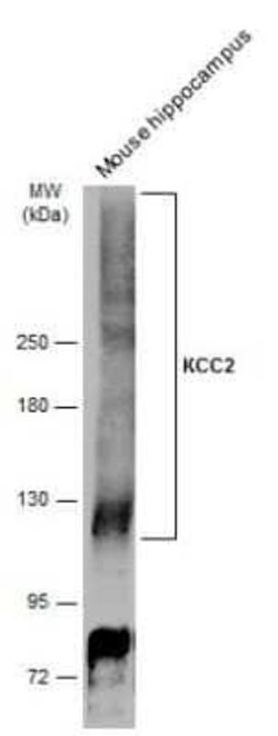 KCC2/SLC12A5 Antibody, Novus Biologicals 100 &mu;g | Buy Online | Novus Biologicals | Fisher Scientific