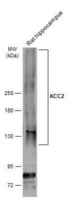 KCC2/SLC12A5 Antibody, Novus Biologicals 100 &mu;g | Buy Online | Novus Biologicals | Fisher Scientific