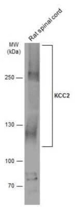 KCC2/SLC12A5 Antibody, Novus Biologicals 100 &mu;g | Buy Online | Novus Biologicals | Fisher Scientific
