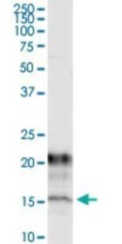 KCNE1 Antibody (2A6), Novus Biologicals 0.1 mg | Buy Online | Novus Biologicals | Fisher Scientific