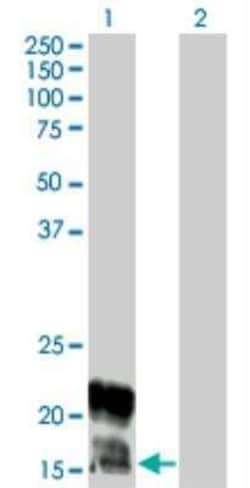 KCNE1 Antibody (5B12), Novus Biologicals 0.1 mg | Buy Online | Novus Biologicals | Fisher Scientific