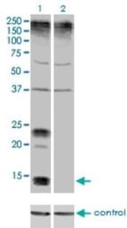 KCNE1 Antibody (5B12), Novus Biologicals 0.1 mg | Buy Online | Novus Biologicals | Fisher Scientific
