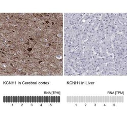 KCNH1 Rabbit anti-Human, Polyclonal, Novus Biologicals 25 &mu;g; Unconjugated:Antibodies,