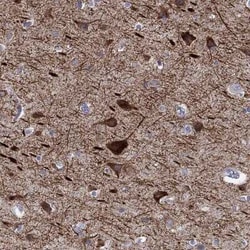 KCNH1 Rabbit anti-Human, Polyclonal, Novus Biologicals 25 &mu;g; Unconjugated:Antibodies,