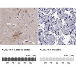 KCNJ10 Antibody, Novus Biologicals:Antibodies:Primary Antibodies