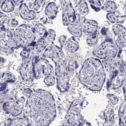 KCNJ10 Antibody, Novus Biologicals:Antibodies:Primary Antibodies