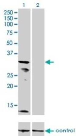 KCNJ15 Antibody (1B2), Novus Biologicals 0.1 mg | Buy Online | Novus Biologicals | Fisher Scientific