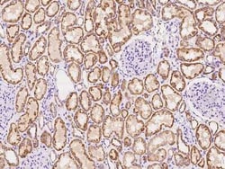 KCNK1 Antibody, Novus Biologicals 100 &mu;g, Unconjugated:Antibodies, Polyclonal