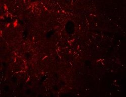 KCNK12 Antibody - BSA Free, Novus Biologicals 0.1 mg; Unconjugated:Antibodies,