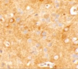 KCNK12 Antibody - BSA Free, Novus Biologicals 0.1 mg; Unconjugated:Antibodies,