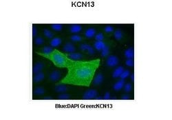 KCNK13 Antibody, Novus Biologicals 100 &mu;L; Unconjugated:Antibodies,