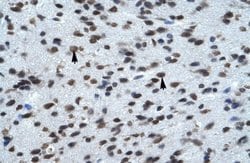KCNK13 Antibody, Novus Biologicals 100 &mu;L; Unconjugated:Antibodies,