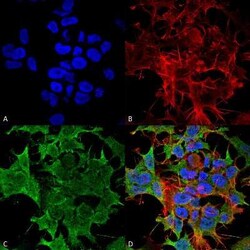 KCNK3 Antibody (S374-48), Novus Biologicals 0.1 mg; Unconjugated:Antibodies,
