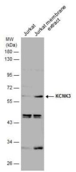 KCNK3 Antibody, Novus Biologicals 100 &mu;g; Unconjugated:Antibodies, Polyclonal