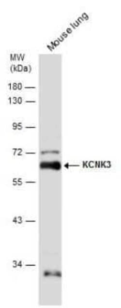 KCNK3 Antibody, Novus Biologicals 100 &mu;g; Unconjugated:Antibodies, Polyclonal