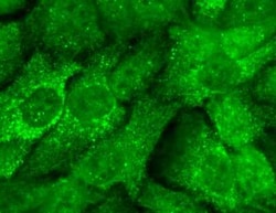 KCNMB2 Antibody (S53-32), Novus Biologicals 0.025 mg; Unconjugated:Antibodies,