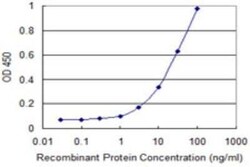 KCNMB3 Antibody (2C12), Novus Biologicals 0.1 mg | Buy Online | Novus Biologicals | Fisher Scientific