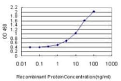 KCNMB3 Antibody (5H1), Novus Biologicals 0.1 mg; Unconjugated:Antibodies,