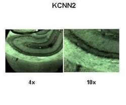 KCNN2 Rabbit anti-Human, Rat, Monkey, Polyclonal, Novus Biologicals 0.1