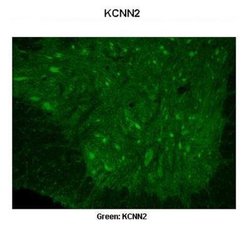 KCNN2 Rabbit anti-Human, Rat, Monkey, Polyclonal, Novus Biologicals 0.1