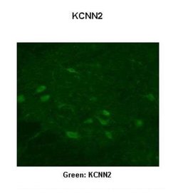 KCNN2 Rabbit anti-Human, Monkey, Polyclonal, Novus Biologicals 0.1 mL;