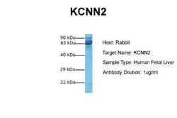KCNN2 Rabbit anti-Human, Rat, Monkey, Polyclonal, Novus Biologicals 0.1