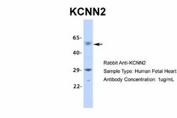 KCNN2 Rabbit anti-Human, Monkey, Polyclonal, Novus Biologicals 0.1 mL;