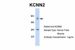 KCNN2 Rabbit anti-Human, Monkey, Polyclonal, Novus Biologicals 0.1 mL;