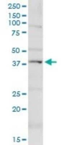 KCNN4 Antibody, Novus Biologicals 0.1 mg, Unconjugated:Antibodies, Polyclonal