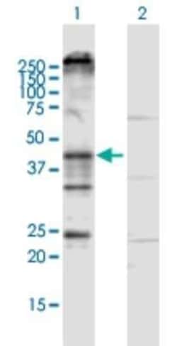 KCNN4 Antibody, Novus Biologicals 0.1 mg, Unconjugated:Antibodies, Polyclonal
