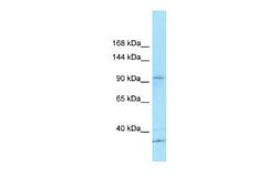 KCP Antibody, Novus Biologicals 100&mu;L; Unlabeled:Antibodies, Polyclonal