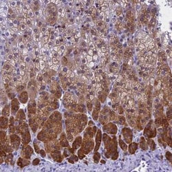 KCTD14 Antibody, Novus Biologicals:Antibodies:Primary Antibodies