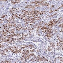 KCTD15 Antibody, Novus Biologicals 25 &mu;L | Buy Online | Novus Biologicals | Fisher Scientific