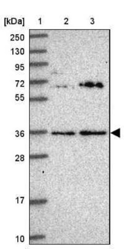 KCTD15 Antibody, Novus Biologicals 25 &mu;L | Buy Online | Novus Biologicals | Fisher Scientific