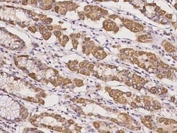 KCTD17 Antibody, Novus Biologicals:Antibodies:Primary Antibodies