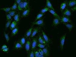 KCTD18 Antibody, Novus Biologicals:Antibodies:Primary Antibodies