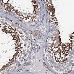 KCTD4 Antibody, Novus Biologicals 0.1 mL | Buy Online | Novus Biologicals | Fisher Scientific