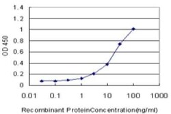 KCTD9 Antibody (1F3), Novus Biologicals 0.1 mg | Buy Online | Novus Biologicals | Fisher Scientific