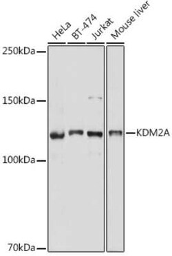 KDM2A/FBXL11 Rabbit anti-Human, Mouse, Polyclonal, Novus Biologicals 20 &mu;g | Buy Online | Novus Biologicals | Fisher Scientific