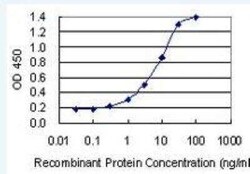 KDM6A Antibody (4E7), Novus Biologicals 0.1 mg, Unconjugated:Antibodies,