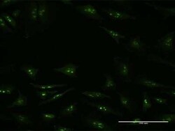 KDM6A Antibody (4E7), Novus Biologicals 0.1 mg, Unconjugated:Antibodies,
