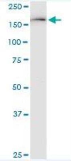 KDM6A Antibody (4E7), Novus Biologicals 0.1 mg, Unconjugated:Antibodies,