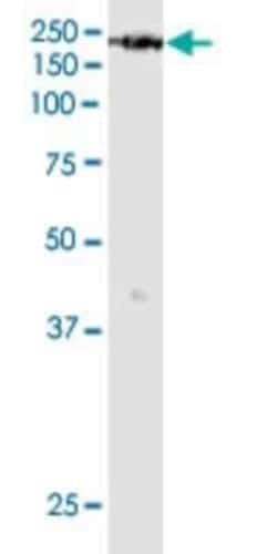 KDM6A Antibody (4E7), Novus Biologicals 0.1 mg, Unconjugated:Antibodies,
